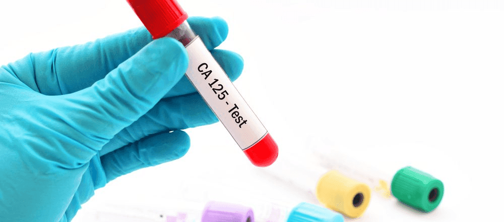 Exame CA 125: o que é, quando é indicado e valores de referência